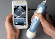 Устройство MobiUS scanner заменит стандартные ультразвуковые сканеры